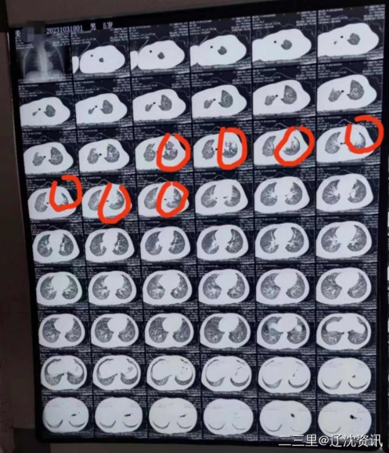 y80000��������